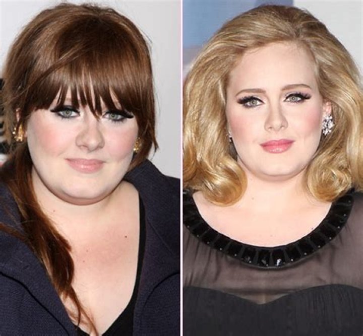 Adele Nose Job — Plastic Surgeons Confirm Adele Plastic Surgery Rumors – Hollywood Life