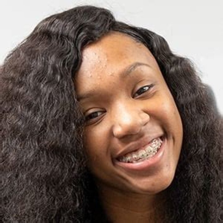 Brace Face Laii Height, Weight, Age, Body Statistics