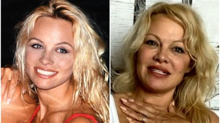 Has Pamela Anderson Had Plastic Surgery? — Surgeon Talks Possible Fat Transfer – Hollywood Life