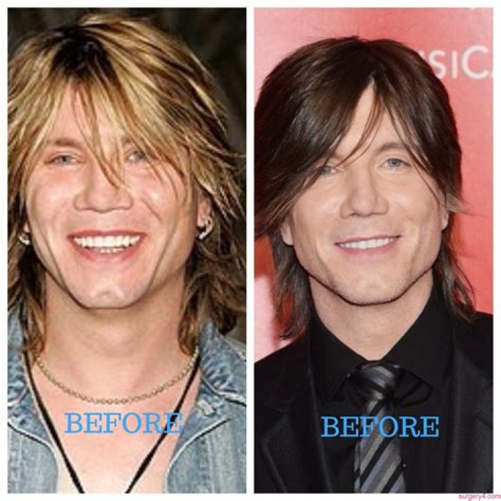 Is Facelift The Reason Why John Rzeznik Still Looks Young At His 5 Before And After Pictures Examined!