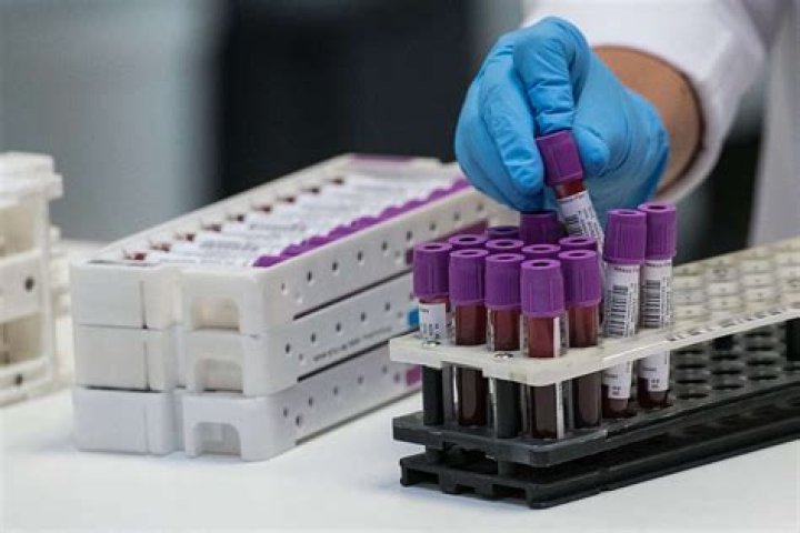 New $3 Blood Test Is "Groundbreaking" in Detecting Cancer, Doctors Say