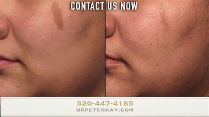 Ryan Day's Plastic Surgery: Skin Care Routine!