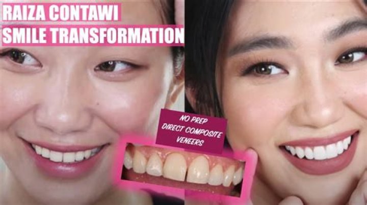 Who is Raiza Contawi Dating Now?